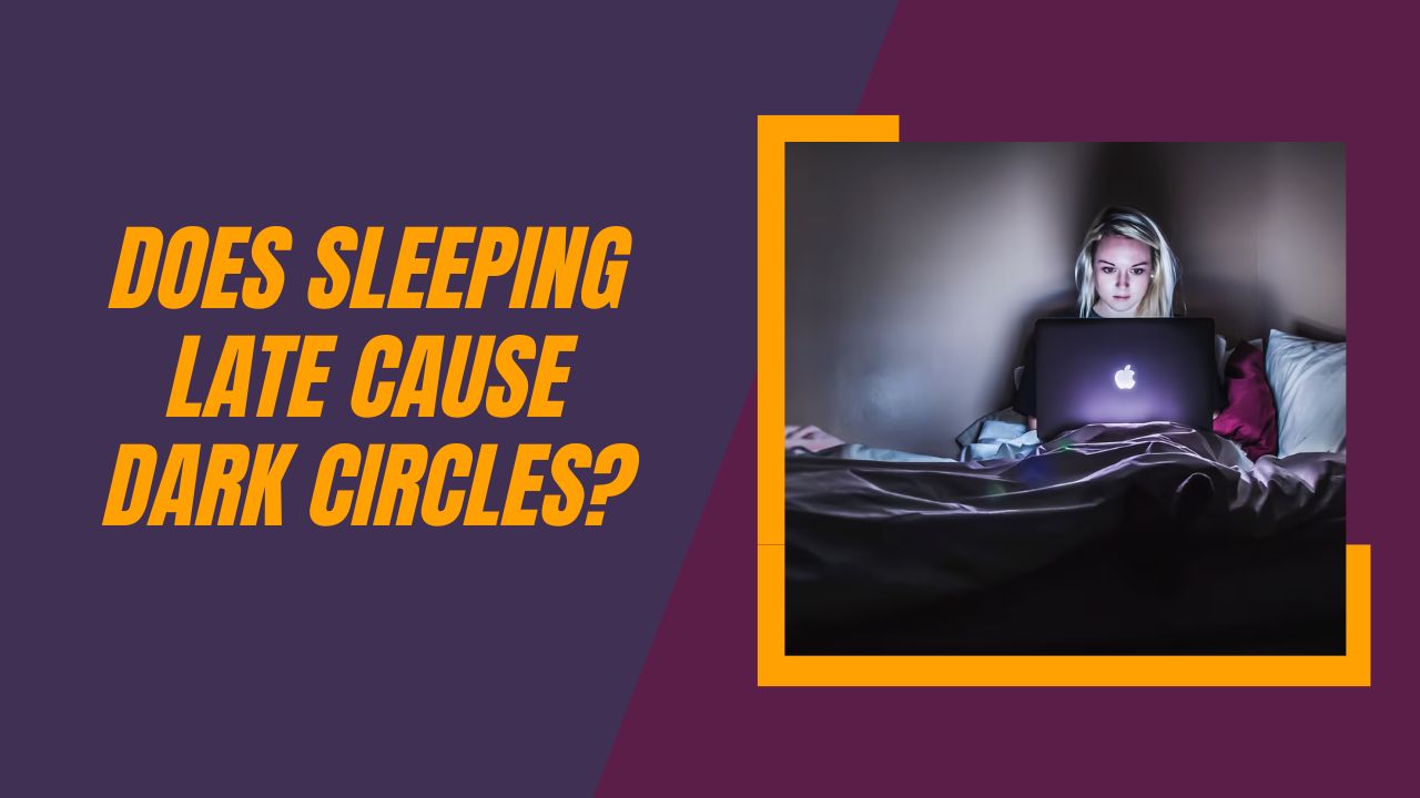 Does Sleeping Late Cause Dark Circles